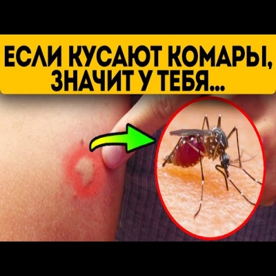 Почему тебя кусают комары и как избавиться от последствий укуса?