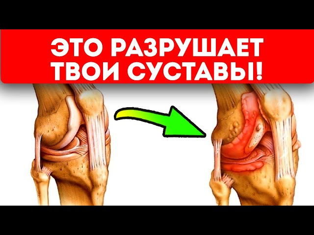 Никогда не делай этого! И твои суставы прослужат тебе до глубокой старости