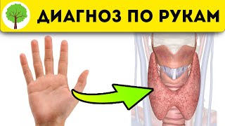 Это экономит кучу денег! Вот что руки расскажут о щитовидке, печени, сердце, легких и даже...