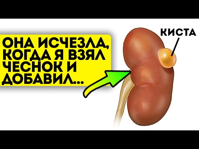 Лекарь согласился! Я просто взял чеснок, пропустил через мясорубку и залил его...