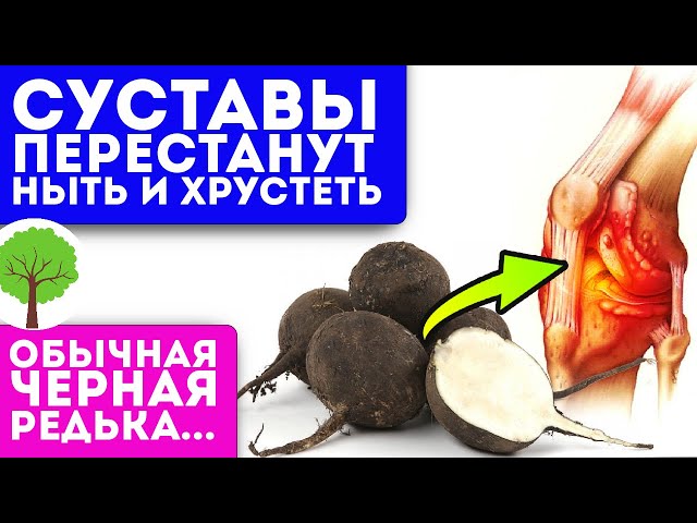 Без боли хожу по лестнице! Колени больше не болят после смеси редьки и...